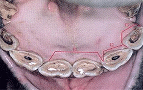 말의 치아 절치